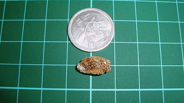 10mm以下の結石