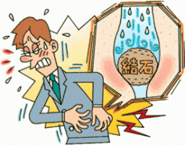 尿路結石で苦しんでいる男性のイラスト